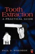 Tooth Extraction: A Practical Guide by Paul D. Robinson (Paperback, 2007)