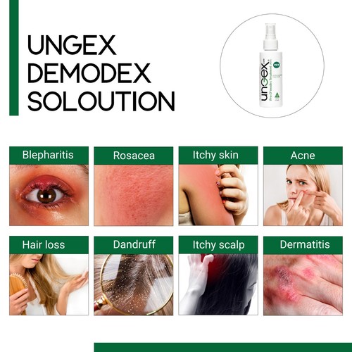 Treat Demodex Mite Demodicosis, Acne Rosacea, Blepharitis, Seborrheic Dermatitis - Picture 2 of 12