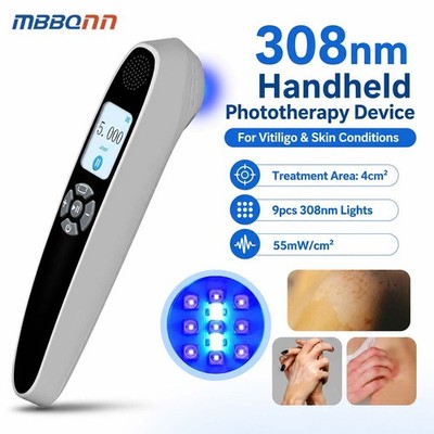 308nm Narrowband UVB Light Device 9 Diodes 55mW/cm2 Handheld Home Skin Care Use