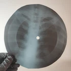 LED ZEPPELIN GALLOWS POLE X-Ray USSR Record Roentgen Bone Ribs Music Vinyl