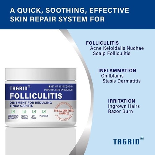 TAGRID Folliculitis, Folliculitis Treatment, Severe Folliculitis Treatment, Lich - Picture 2 of 5