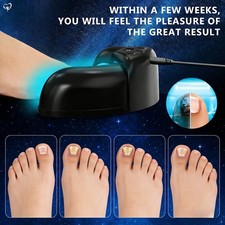 KTS Nail Fungus Laser Device - Cure Onychomycosis  Clean Toenails Efficiently