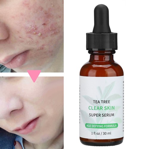 30ml Tea Tree Oil Facial Serum Face Moisturizing Oil Control Shrink Remove Serum