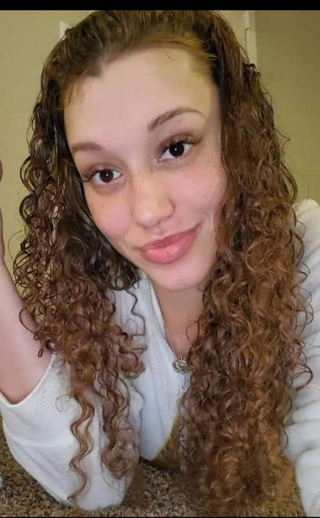 Organic Hair Growth Oil Serum treatment  1 oz. Alopecia,Bald Spots,Thinning hair