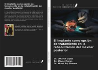 El Implante Como OpcióN De Tratamiento En La RehabilitacióN Del Maxilar Posterio