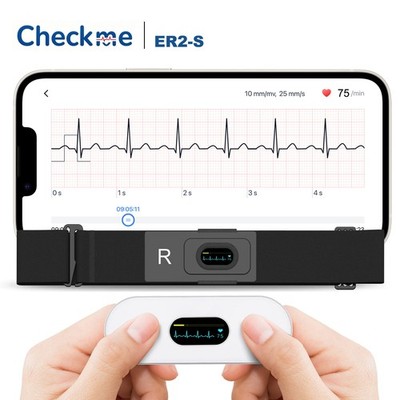 CheckMe ER2-S Mobiles EKG-Gerät Herzmonitor mit Brustgurt Kabellose KI-Analyse