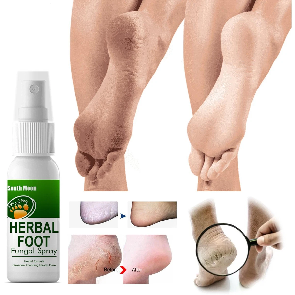 Spray for shop sweaty feet