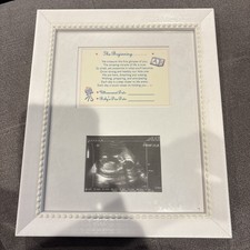 NEW The Beginning Sonogram Picture Frame, Gender Neutral Ultrasound Keepsake
