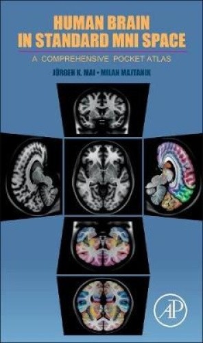 Human Brain in Standard Mni Space: A Comprehensive Pocket Atlas [Paperback]