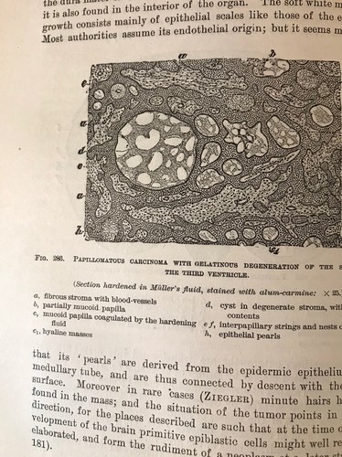 Textbook of Pathological Anatomy part 3 (1887) Wood’s Library, Antique Medical - Picture 18 of 18