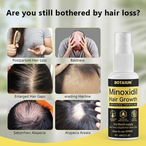 Suero avanzado para el crecimiento del cabello 60 ml spray tratamiento para la pérdida del cabello para hombres suministro para 1 mes - Imagen 3 de 3