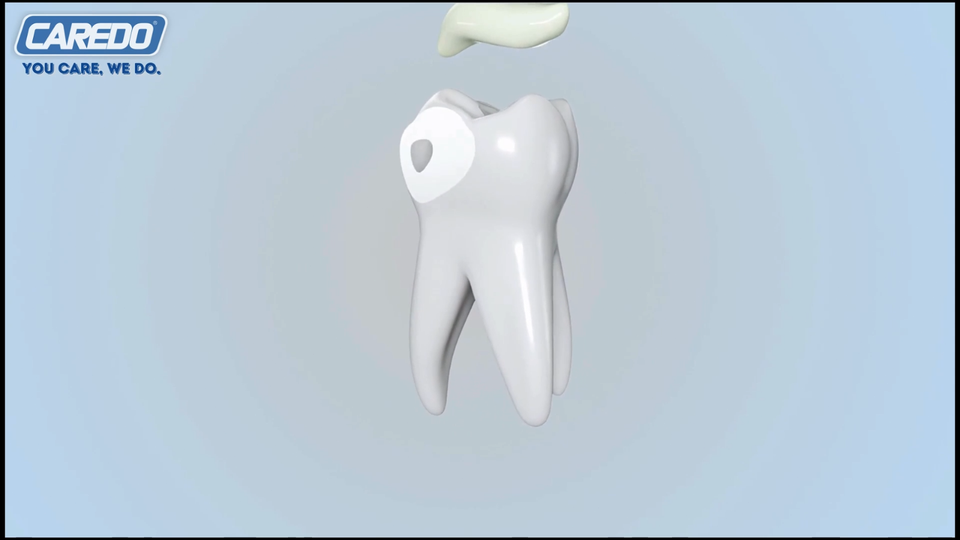 Vg Toothpaste CAREDO Cavity Repair Toothpaste Tooth Enamel Remineralizing ...