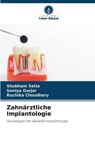 ZahnäRztliche Implantologie Ruchika Choudhary-image