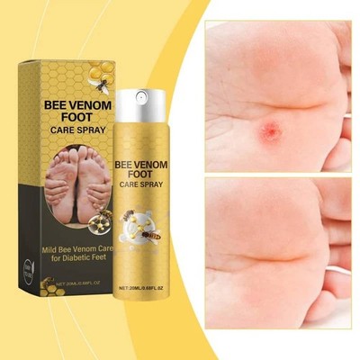 Herbal Bee Venom Gentle Nourishing & Moisturizing Foot Spray for Daily Foot Care