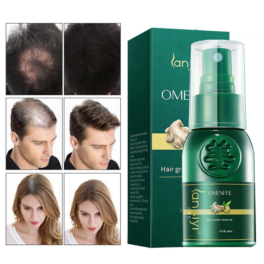 30ml Spray Hair Growth Fast Growth Hair Loss Prevention Dense Beauty Makeup  | eBay