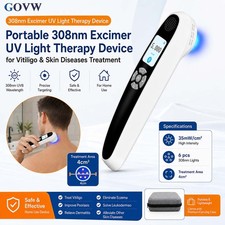 308nm UVB Excimer Phototherapy Device Facial Light Therapy Portable Rechargeable