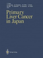 Takayoshi Tobe (U. A.) | Primary Liver Cancer In Japan | Taschenbuch | Englisch