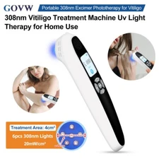 308NM UV Narrow Band Ultraviolet Light Therapy for skin disease
