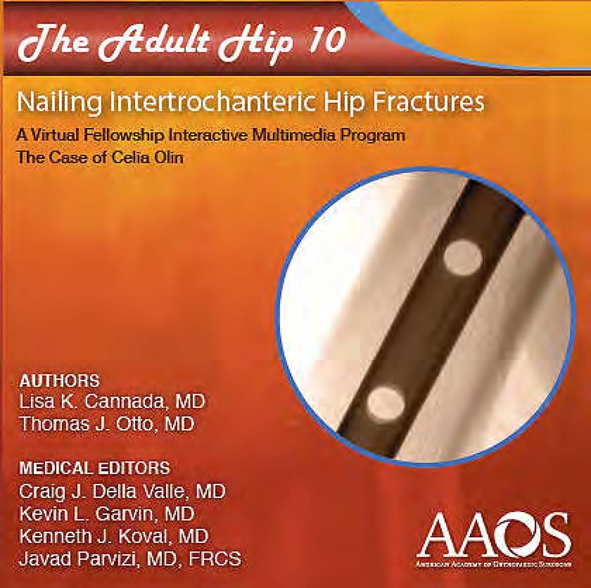 The Adult Hip 10: Nailing Intertrochanteric Hip Fractures The Case of Celia Olin