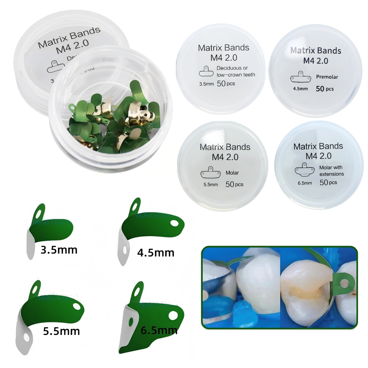50 Bandes Matrices Dentaires Palodent V3 Style - Acier Inoxydable 0.038mm - Pour Restaurations Composites - Neuf