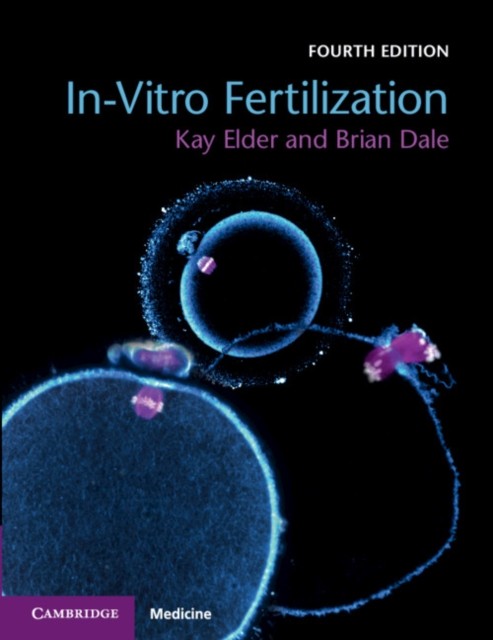 In-Vitro Fertilization by Brian Dale (Paperback Book)