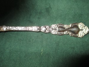 How common is bell's palsy image