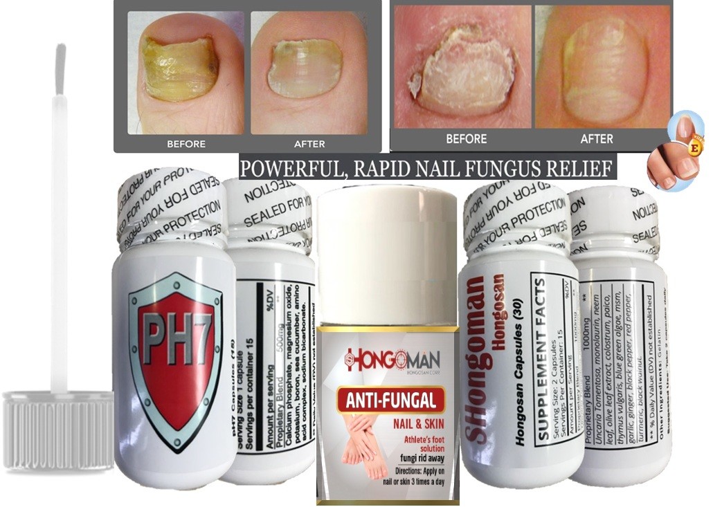 ZANA ANTI HONGOS UÑAS cápsulas soporte uñas claras rápido