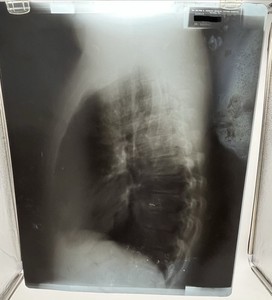 25+ Old X-Ray for sale | Updated Oct 2026