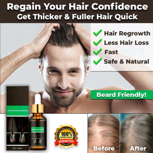 NEW FAST HAIR GROWTH OIL LOSS TREATMENT PRO NATURAL SAFE POWERFUL BEARD BODY - Picture 1 of 6