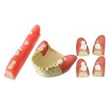 Dental Impacted Tooth Extraction Practice Model Wisdom Teeth Training Students