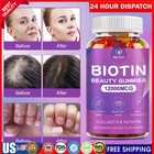 Vitamatic Biotin Gummies 12000 Mcg for Stronger Hair Skin Nails 60 Vegan Gummies