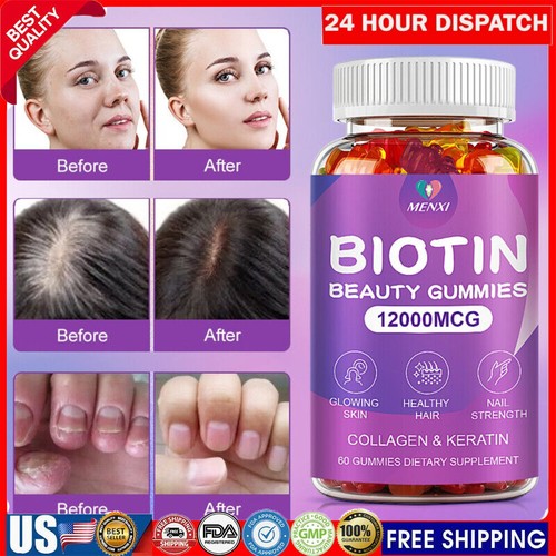 Vitamatic Biotin Gummies 12000 Mcg for Stronger Hair Skin Nails 60 Vegan Gummies - Picture 1 of 18