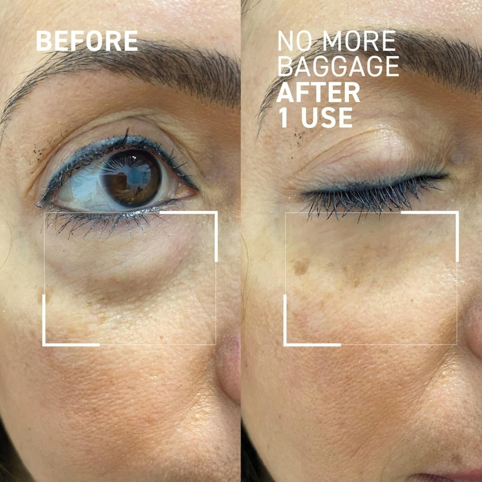 Dr. Brandt Needles No More, No More Baggage - Minimizes Under-Eye Bags, Puffines - Image 3 of 4