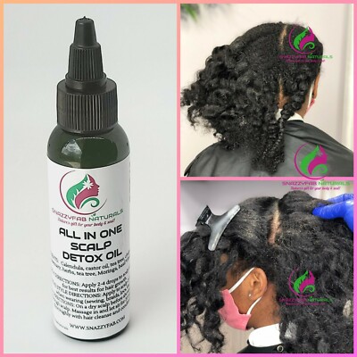 SCALP DETOX oil scalp oil hair growth oil dandruff oil promote rapid hair growth