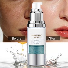 NEW Total Package Serum, All-In-One Vitamin C, Hyaluronic Acid, Peptides Serum
