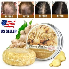 3PCS Ginger Hair Regrowth Shampoo Bar Hair Growth Soap Hair Loss Treatment USA