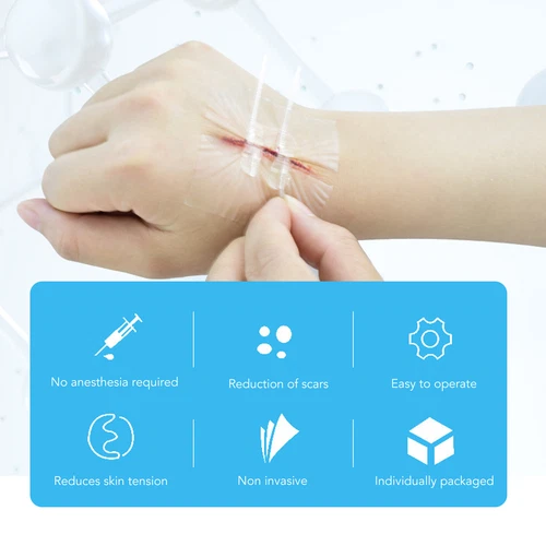 10x Emergency Wound Closures Adhesive Seamless Cuttable Hygienic Zip Stitch - Picture 4 of 23