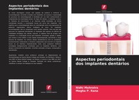 Nidhi Mehrotra (U. A.) | Aspectos Periodontais Dos Implantes DentáRios | Buch