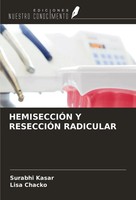 HemisecciÓN Y ResecciÓN Radicular Surabhi Kasar (U. A.) Taschenbuch Spanisch