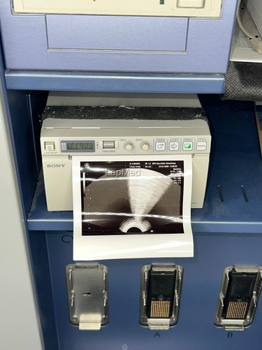 GE Voluson 730 Pro Ultraschall ultrasound (32321) - Picture 5 of 15