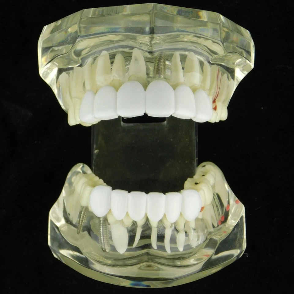 White Teeth Grillz Set Teeth Bright Smile Snap-On False Fake Grills Top & Bottom - Image 3 of 4