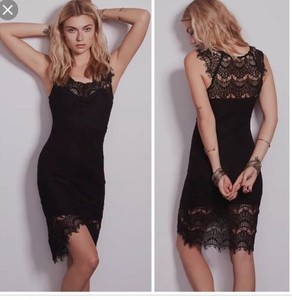 scalloped lace dress