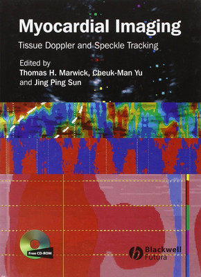 Myocardial Imaging: Tissue Doppler and Speckle Tracking