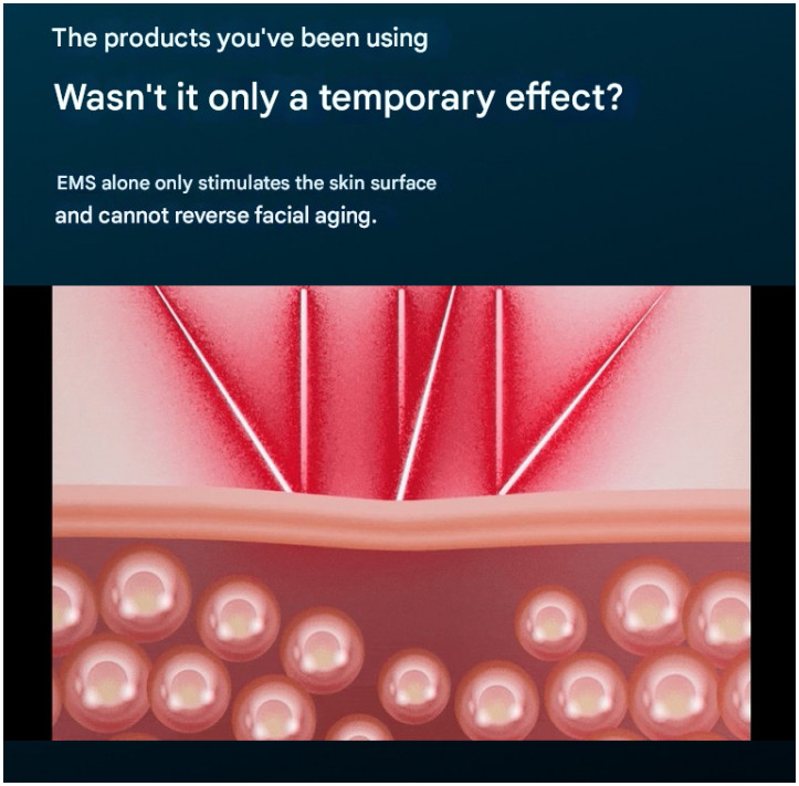 Honbody V-Shape Face Line Massger EMS Roller Anti-Wrinkles Lifting Anti-Ageing