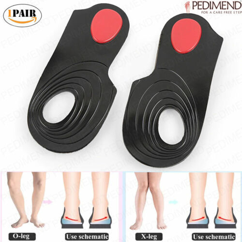 Plaquettes de gel orthopédiques en silicone Pedimend 3/4 longueur X/O jambes - 1 PAIRE - UK - Photo 1/7