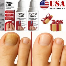 Fungi-Nail Anti-Fungal Liquid Solution Kills Fungus That Can Lead To Nail