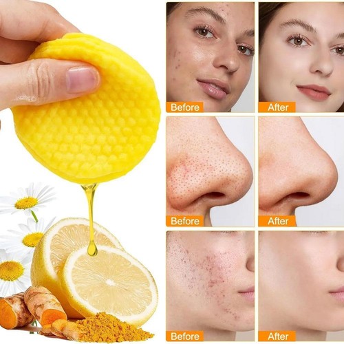 Tamponi detergenti per curcuma, acido cogico e tamponi detergenti per curcuma 50 cialde 20248 - Foto 9 di 10