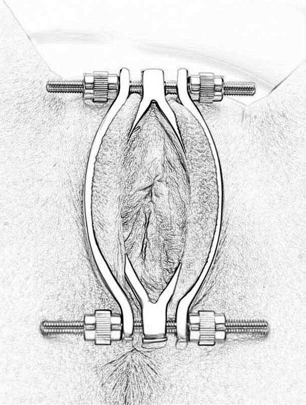 Nogiron odam bilan jinsiy aloqa, erotika