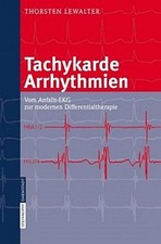 Tachykarde Arrhythmien Thorsten Lewalter