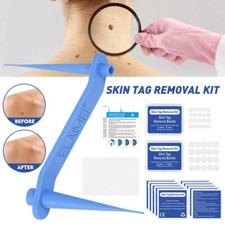 2in1 Micro Skin Tag Remover tool Kit Painless Wart Acne Skin Tags Removal Device